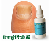 Gotas Contra Hongos De Las Uñas: ¿Uñas dañadas, amarillas o con mal olor? La solución está aquí